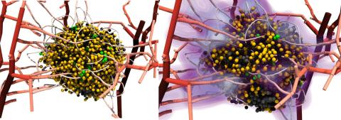 Final tumour before treatment (left) and at early stage of treatment (right). (Image: adapted from T. Duswald et al., Computer Methods in Applied Mechanics and Engineering, 2024)